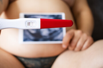 Mulher segurando teste de gravidez e uma foto de ultrassom.